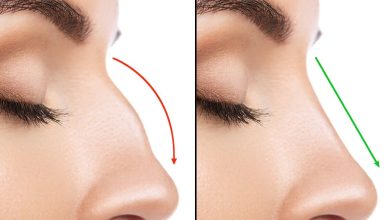 Nose Filler Surgery and prices