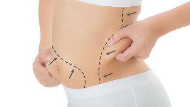 Liposuction Fat Removal